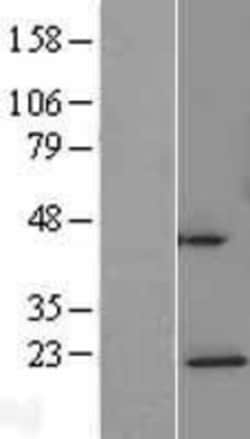 Novus Biologicals&trade;&nbsp;NDUFAF4 Overexpression Lysate