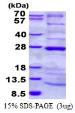Novus Biologicals&trade;&nbsp;Recombinant Human NDUFAF4 His Protein