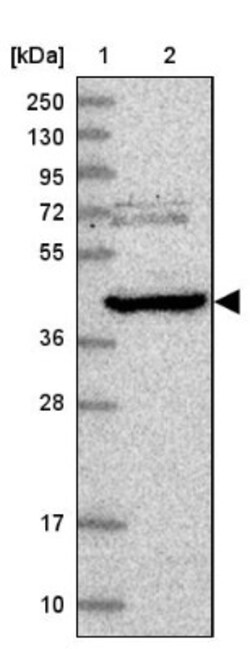 NDUFAF6 Antibody, Novus Biologicals 25ul | Buy Online | Novus Biologicals | Fisher Scientific