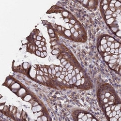 NDUFAF6 Antibody, Novus Biologicals 25ul | Buy Online | Novus Biologicals | Fisher Scientific