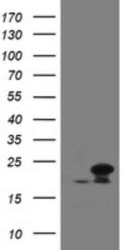 NDUFB10 Antibody (OTI1H6), Novus Biologicals 0.1 mL | Buy Online | Novus Biologicals | Fisher Scientific