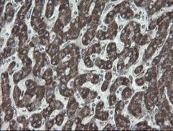 NDUFB10 Antibody (OTI1H6), Novus Biologicals 0.1 mL | Buy Online | Novus Biologicals | Fisher Scientific