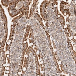 NDUFB11 Antibody, Novus Biologicals:Antibodies:Primary Antibodies