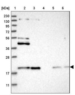 NDUFB11 Antibody, Novus Biologicals:Antibodies:Primary Antibodies