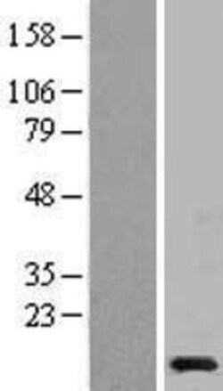 Novus Biologicals&trade;&nbsp;NDUFB2 Overexpression Lysate