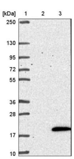 NDUFB3 Antibody, Novus Biologicals 25 &mu;L | Buy Online | Novus Biologicals | Fisher Scientific