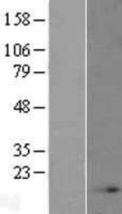 Novus Biologicals&trade;&nbsp;NDUFB4 Overexpression Lysate