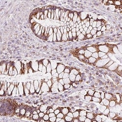 NDUFB4 Antibody, Novus Biologicals 25 &mu;L, Unlabeled:Antibodies, Polyclonal