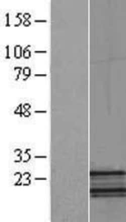 Novus Biologicals&trade;&nbsp;NDUFB5 Overexpression Lysate