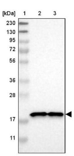 NDUFB7 Antibody, Novus Biologicals 0.1mL; Unlabeled:Antibodies, Polyclonal