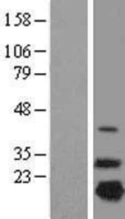 Novus Biologicals&trade;&nbsp;NDUFB7 Overexpression Lysate