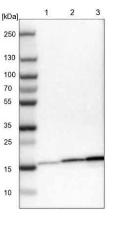 NDUFB7 Antibody, Novus Biologicals 0.1mL; Unlabeled:Antibodies, Polyclonal