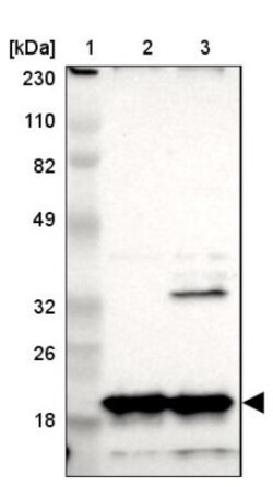 NDUFB8 Antibody, Novus Biologicals 25 &mu;L | Buy Online | Novus Biologicals | Fisher Scientific