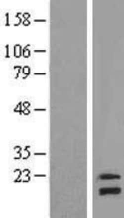 Novus Biologicals&trade;&nbsp;NDUFB8 Overexpression Lysate
