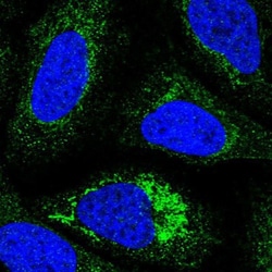 NDUFC1 Antibody, Novus Biologicals:Antibodies:Primary Antibodies