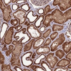 NDUFC1 Antibody, Novus Biologicals:Antibodies:Primary Antibodies