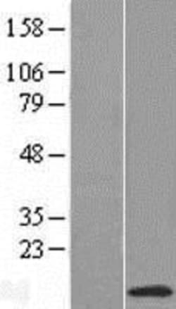 Novus Biologicals&trade;&nbsp;NDUFC1 Overexpression Lysate