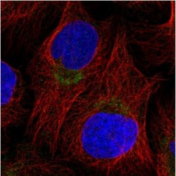 NDUFC2 Antibody, Novus Biologicals 0.1mL; Unlabeled:Antibodies, Polyclonal