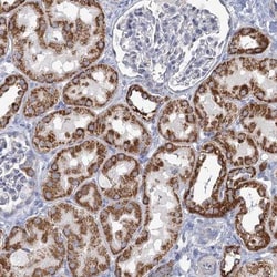 NDUFC2 Antibody, Novus Biologicals 0.1mL; Unlabeled:Antibodies, Polyclonal