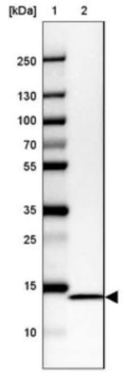 NDUFC2 Antibody, Novus Biologicals 0.1mL; Unlabeled:Antibodies, Polyclonal