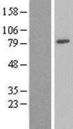 Novus Biologicals&trade;&nbsp;Ndufs1 Overexpression Lysate