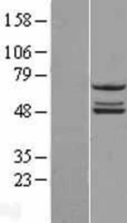 Novus Biologicals&trade;&nbsp;NDUFS2 Overexpression Lysate