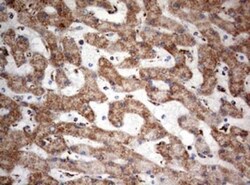 NDUFS2 Antibody (OTI1D5), Novus Biologicals 0.1mL; Unlabeled:Antibodies,