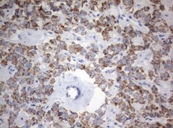 NDUFS2 Antibody (OTI1D5), Novus Biologicals 0.1mL; Unlabeled:Antibodies,