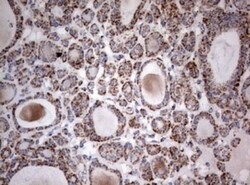 NDUFS2 Antibody (OTI1D5), Novus Biologicals 0.1mL; Unlabeled:Antibodies,