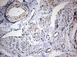 NDUFS2 Antibody (OTI1D5), Novus Biologicals 0.1mL; Unlabeled:Antibodies,