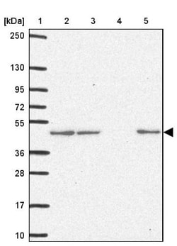 NDUFS2 Antibody, Novus Biologicals:Antibodies:Primary Antibodies