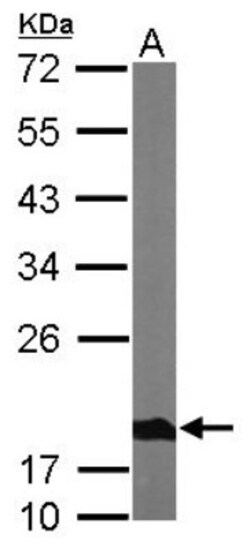Ndufs4 Antibody, Novus Biologicals 0.1mg; Unlabeled:Antibodies, Polyclonal