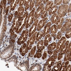 Ndufs4 Antibody, Novus Biologicals 25 &mu;L; Unlabeled:Antibodies, Polyclonal