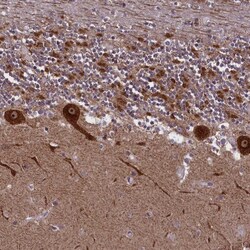 NDUFS5 Antibody, Novus Biologicals 25 &mu;L, Unlabeled:Antibodies, Polyclonal