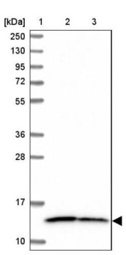 NDUFS5 Antibody, Novus Biologicals 25 &mu;L, Unlabeled:Antibodies, Polyclonal