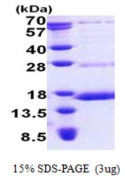Novus Biologicals&trade;&nbsp;Recombinant Human NDUFS6 His Protein