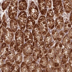 NDUFS6 Antibody, Novus Biologicals:Antibodies:Primary Antibodies