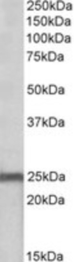 NDUFS8 Antibody, Novus Biologicals 0.1mg; Unlabeled:Antibodies, Polyclonal