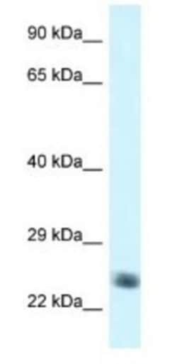 NDUFS8 Antibody, Novus Biologicals:Antibodies:Primary Antibodies