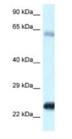 NDUFS8 Antibody, Novus Biologicals:Antibodies:Primary Antibodies