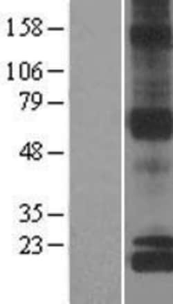 Novus Biologicals&trade;&nbsp;NDUFS8 Overexpression Lysate