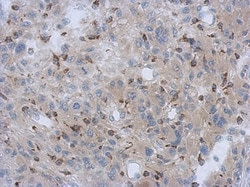 NDUFV1 Antibody, Novus Biologicals 100 &mu;L | Buy Online | Novus Biologicals | Fisher Scientific