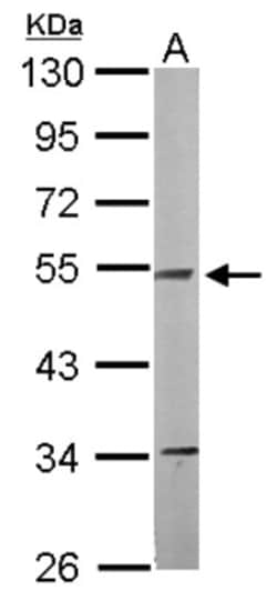 NDUFV1 Antibody, Novus Biologicals 100 &mu;L | Buy Online | Novus Biologicals | Fisher Scientific