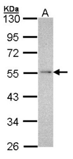 NDUFV1 Antibody, Novus Biologicals 100 &mu;L | Buy Online | Novus Biologicals | Fisher Scientific