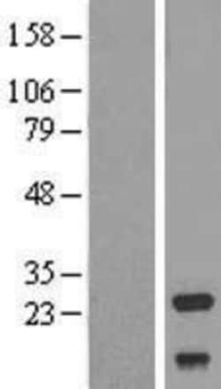 Novus Biologicals&trade;&nbsp;NDUFV2 Overexpression Lysate