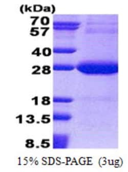 Novus Biologicals&trade;&nbsp;Recombinant Human NDUFV2 His Protein