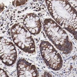 NDUFV2 Antibody, Novus Biologicals:Antibodies:Primary Antibodies