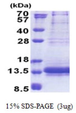 Novus Biologicals&trade;&nbsp;Recombinant Human NDUFV3 His Protein