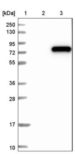 NDUFV3 Antibody, Novus Biologicals:Antibodies:Primary Antibodies