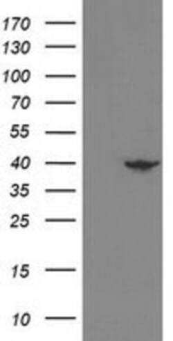 NECAB1 Antibody (OTI4G8), Novus Biologicals 0.1mL; Unlabeled:Antibodies,